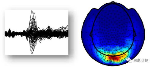 思影數(shù)據(jù)處理服務(wù)六 腦磁圖（MEG）數(shù)據(jù)處理與軟件開發(fā)